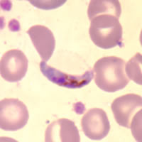 malaria_P_falciparum